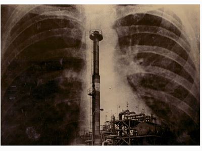 Fabrica Y Pulmones