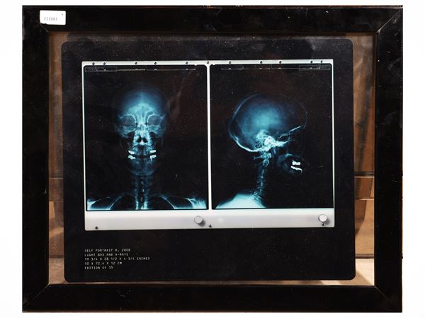 Damien Hirst, Self Portrait X-Ray, 2008